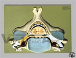 Fifth Cervical Vertebra